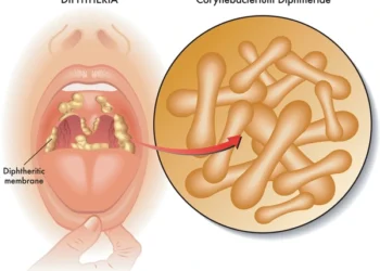 Diphtheria Outbreak: Ohonbamu Urges Parents to Vaccinate Children