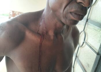 BREAKING: JED PLC Condemns Police Brutality on Staff