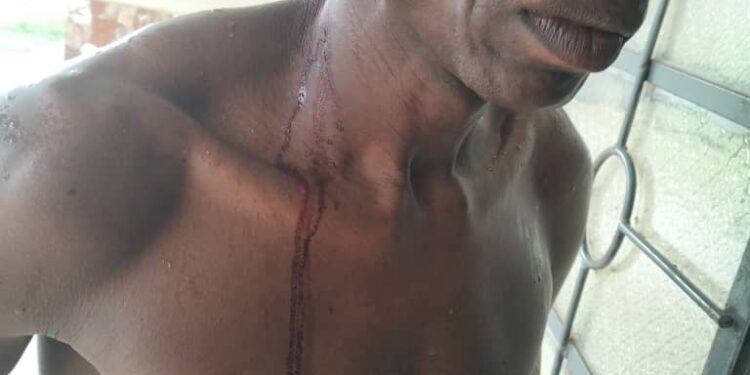 BREAKING: JED PLC Condemns Police Brutality on Staff